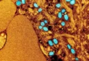 OMS anuncia que Mpox deixa de ser emergência de saúde internacional