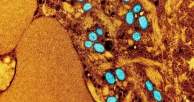 OMS anuncia que Mpox deixa de ser emergência de saúde internacional